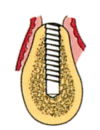 STEP2.Cvgp(2)